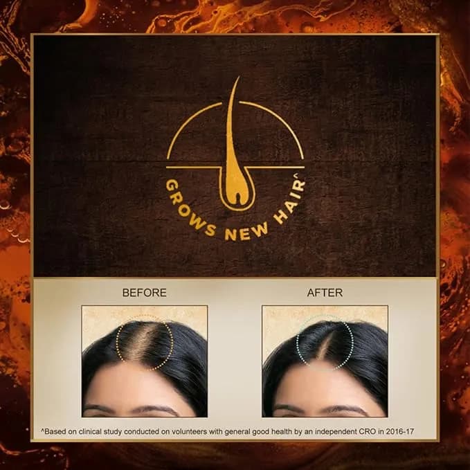 Indulekha Bringha Oil|| Reduces Hair Fall and Grows New Hair|| 100% Ayurvedic Oil|| 250ml Main Image 2